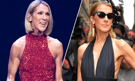 what's wrong with celine dion weight loss.